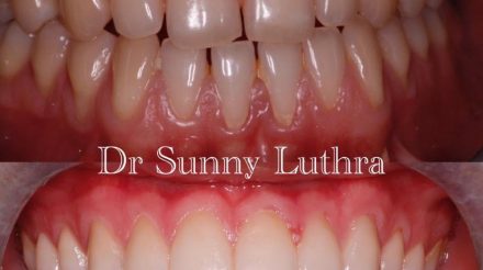 Dr Sunny Luthra
