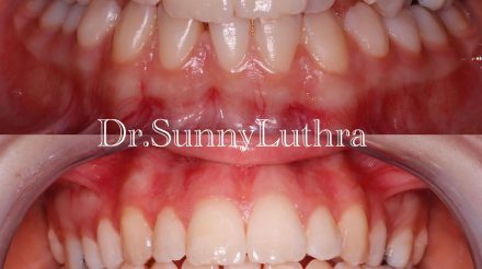 Dr Sunny Luthra
