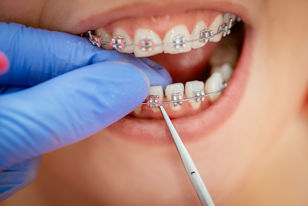 growth in adult orthodontic treatment